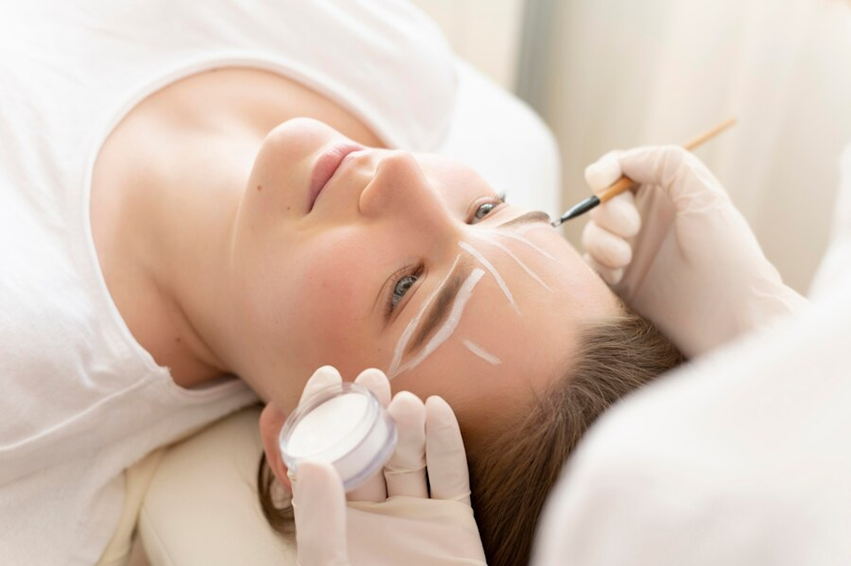Brow lift