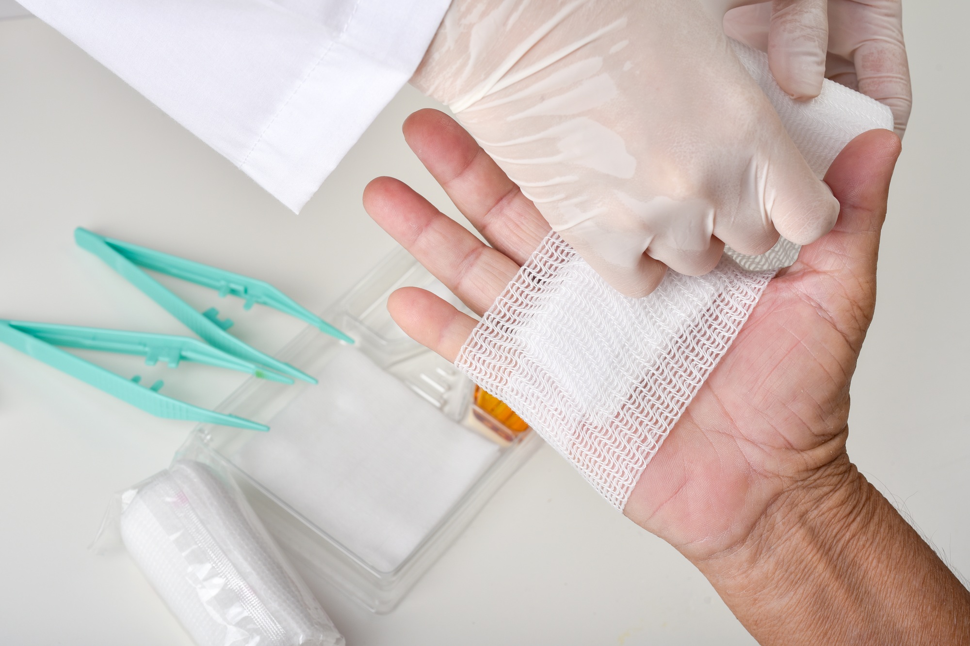 infection du point de suture
