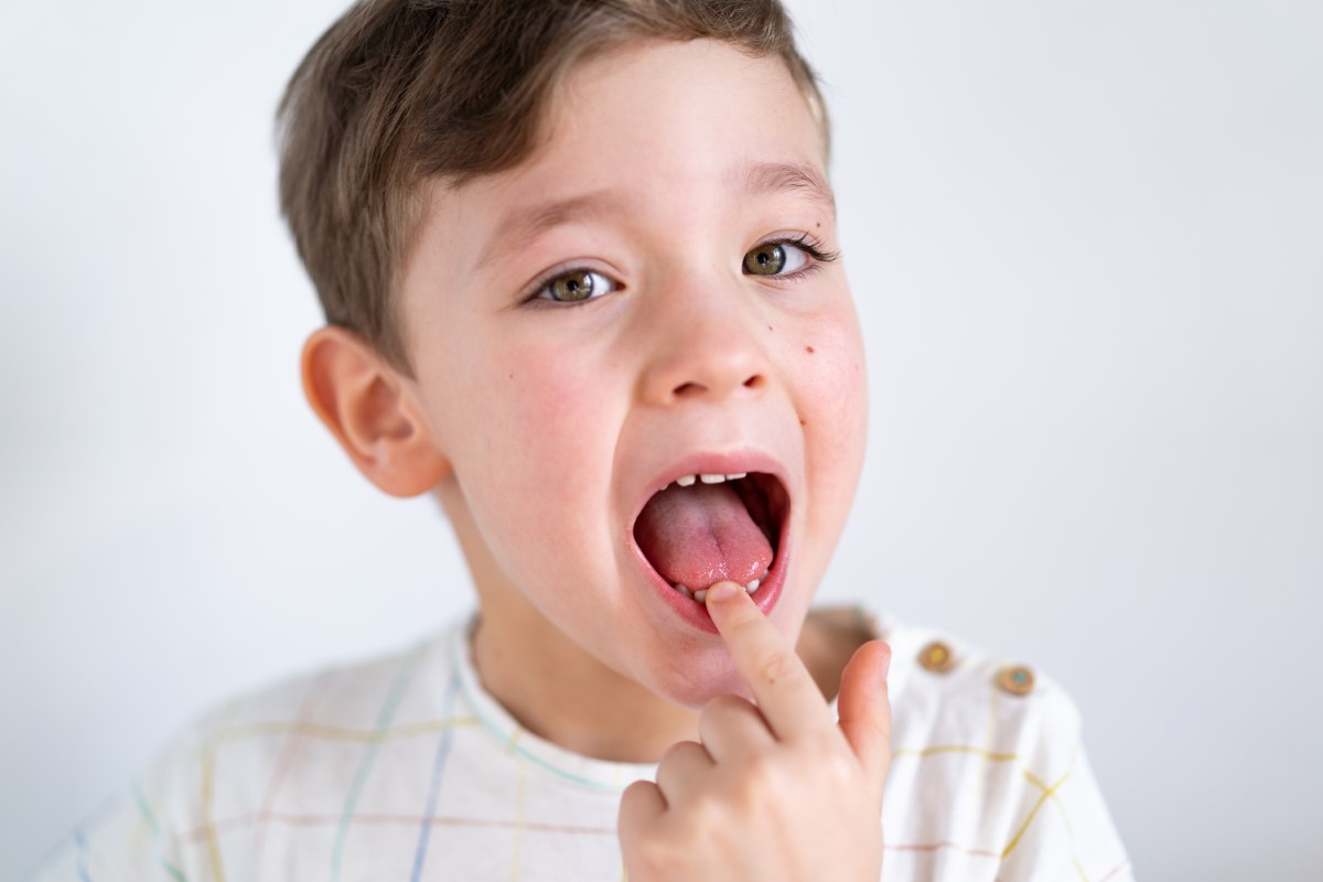 Comment enlever une dent qui bouge sans douleur ?