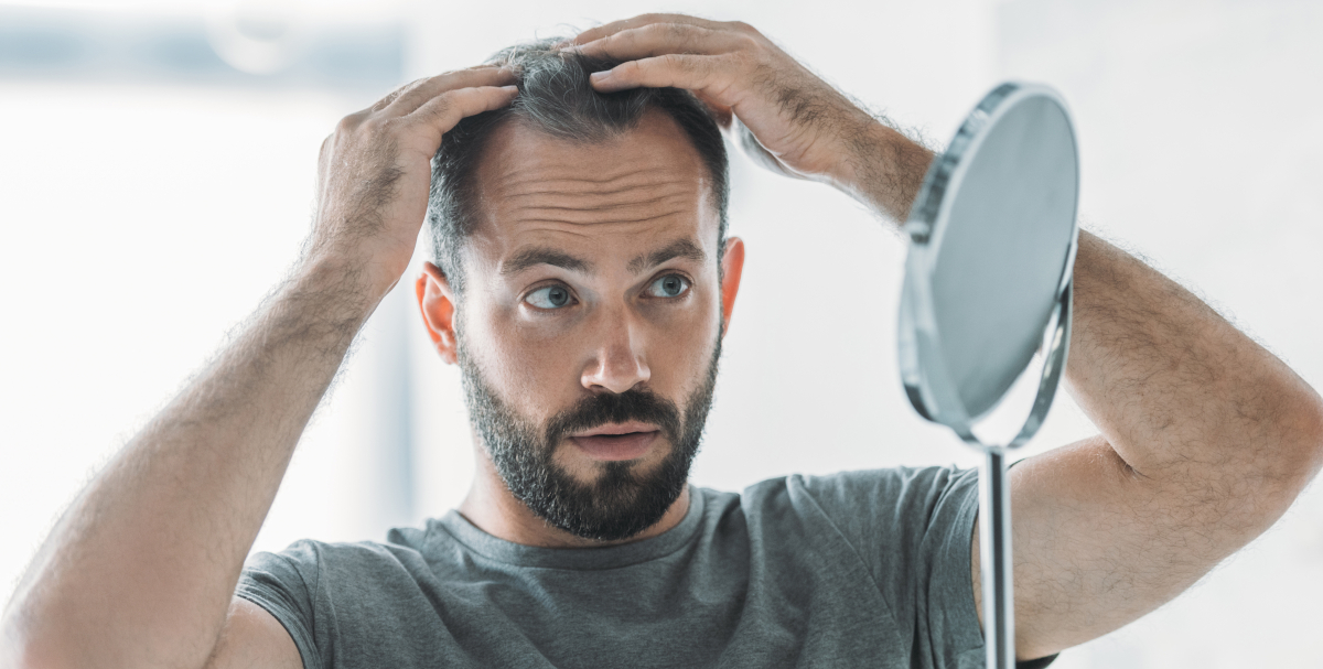 greffe de cheveux