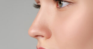 rhinoplastie Nice