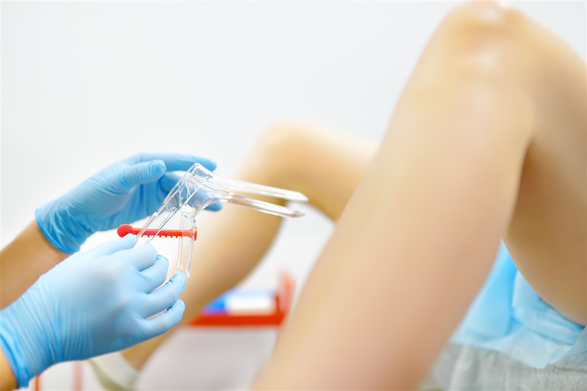 speculum gynecologique